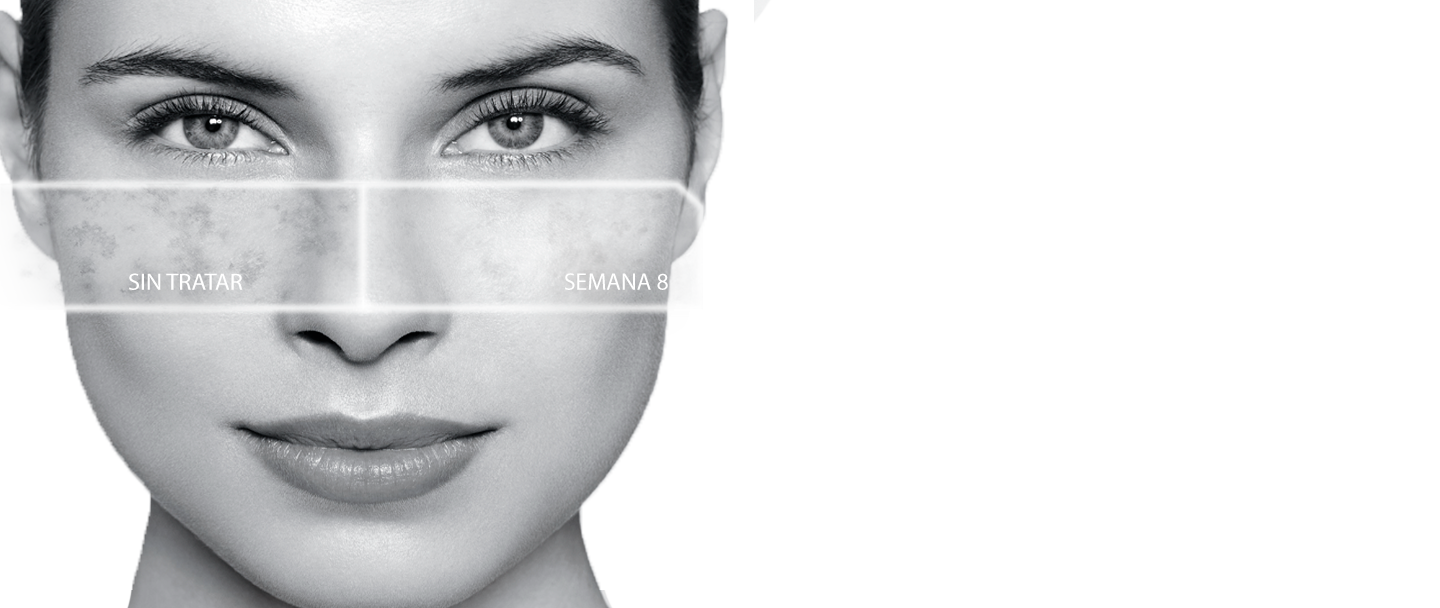 EUCERIN-INT-anti-pigment-header2