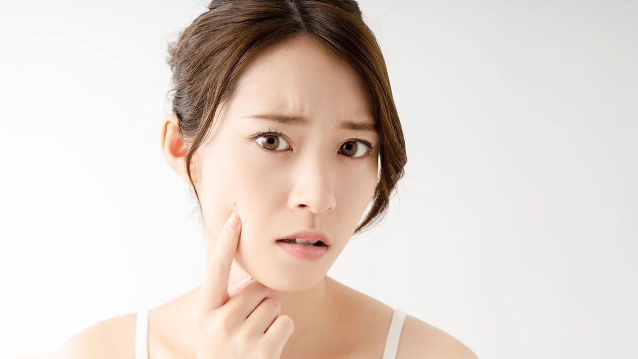 ฝ้า กระ กระลึก