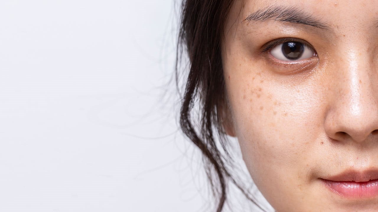 ดูแล ลดฝ้ากระ จุดด่างดำ ให้ผิวหน้ากระจ่างใสได้ทุกมิติ - Eucerin