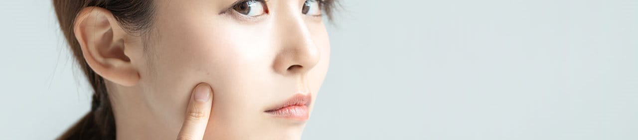 สิวผดที่แก้ม