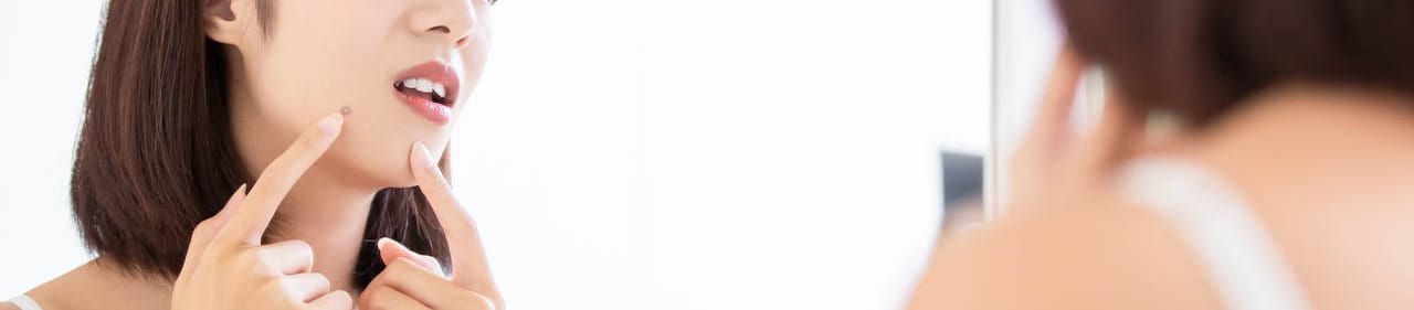 สิวเป็นไต