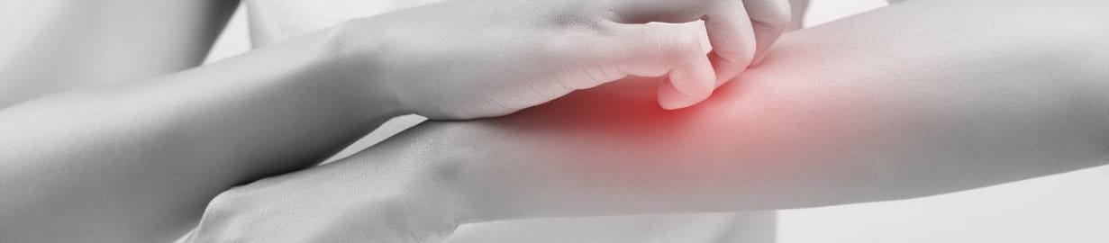 ผิวหนังอักเสบ