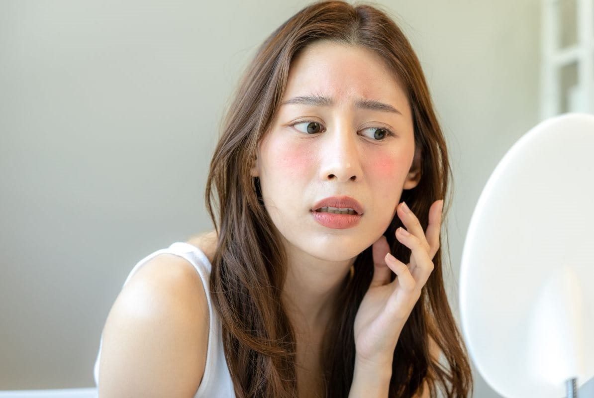 แพ้น้ำ ผื่นลมพิษขึ้น