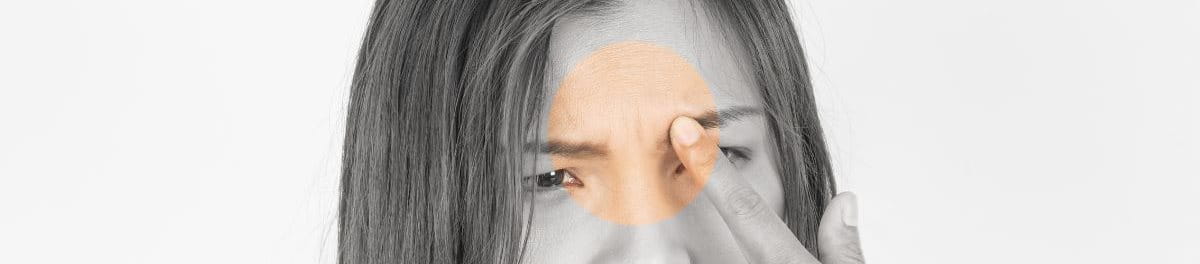 สิว ขึ้น ระหว่าง คิ้ว