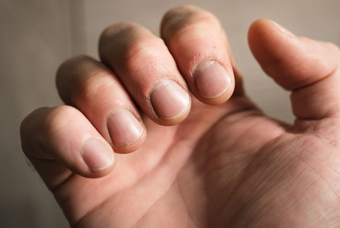 เล็บ เป็น คลื่น