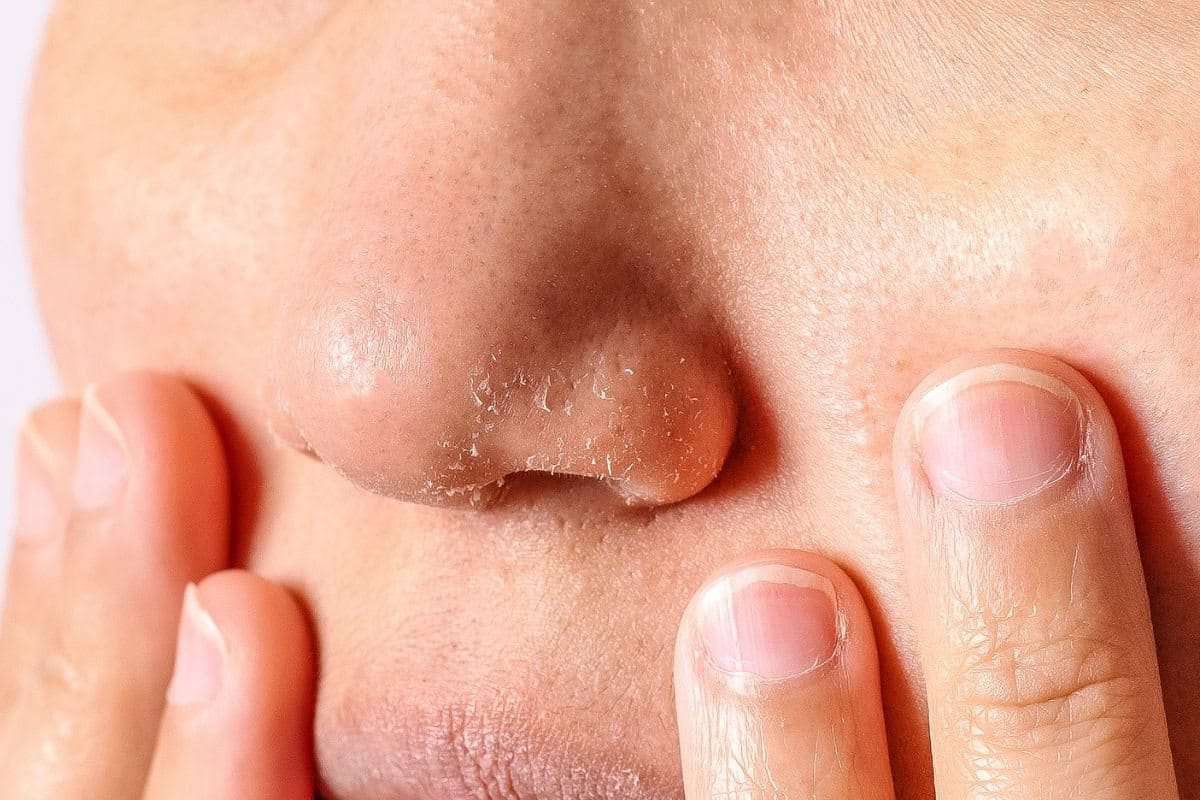 จมูก ลอก