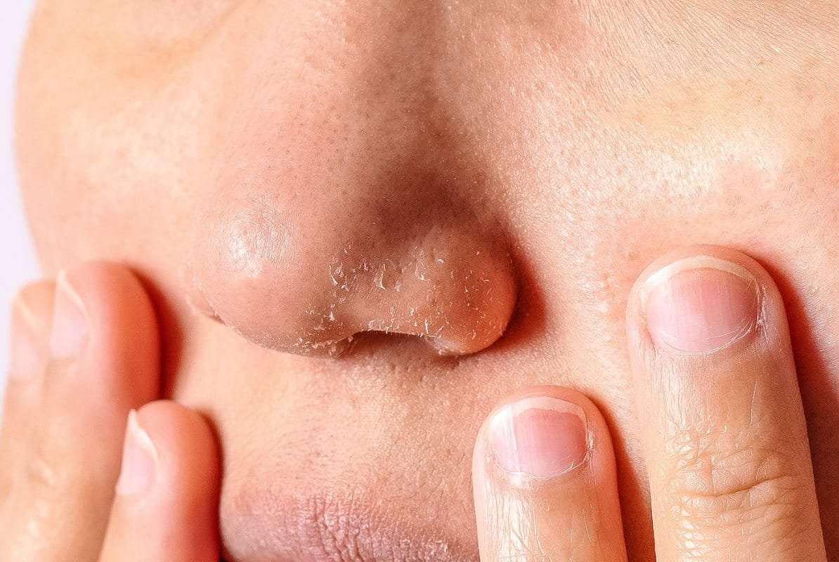 จมูก ลอก