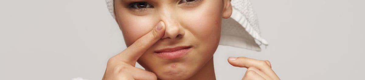 สิวในจมูก