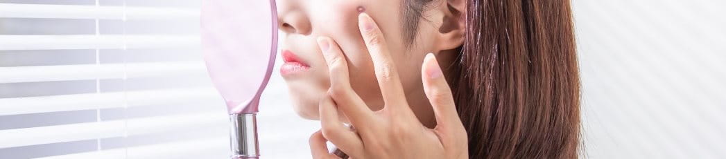 ครีมลดรอยสิว,ลดรอยแผลสิว,รอยดำ,รอยแดง