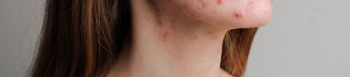 ฮอร์โมน