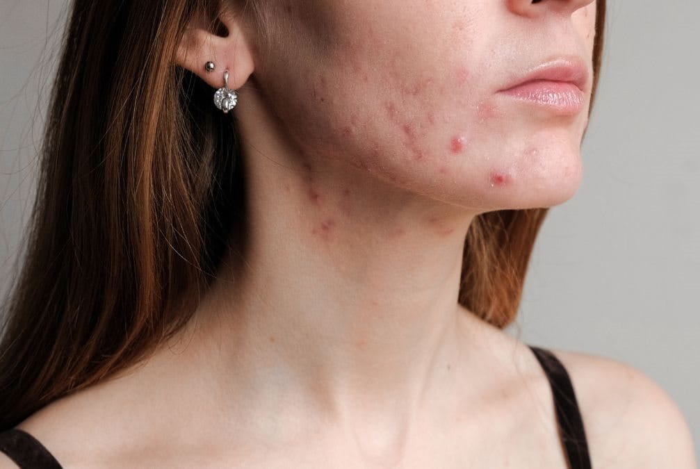 ฮอร์โมน