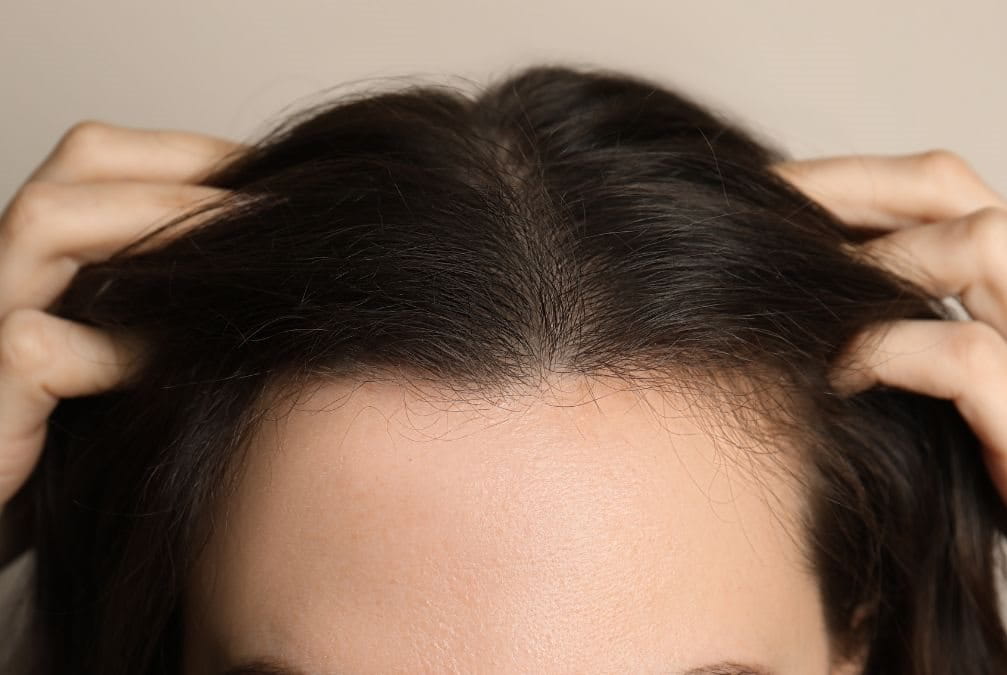 ผมร่วง
