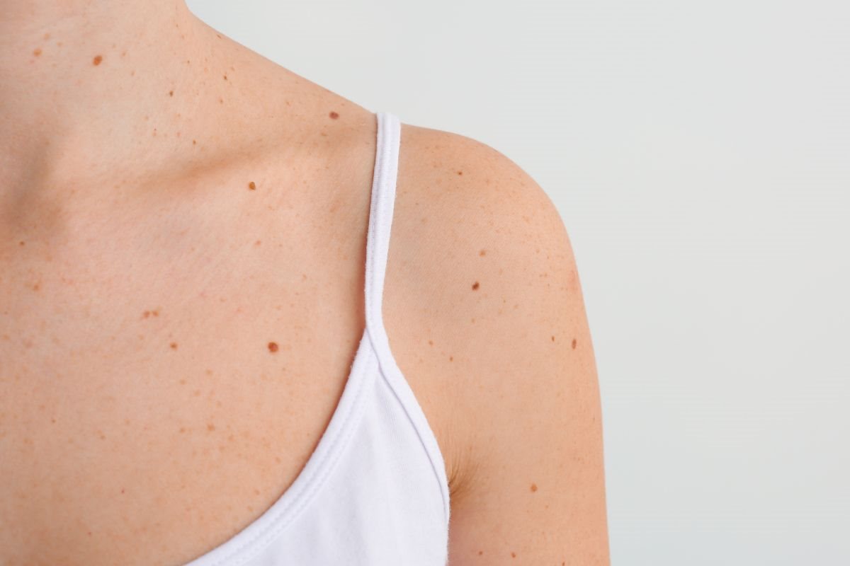  ขี้แมลงวัน