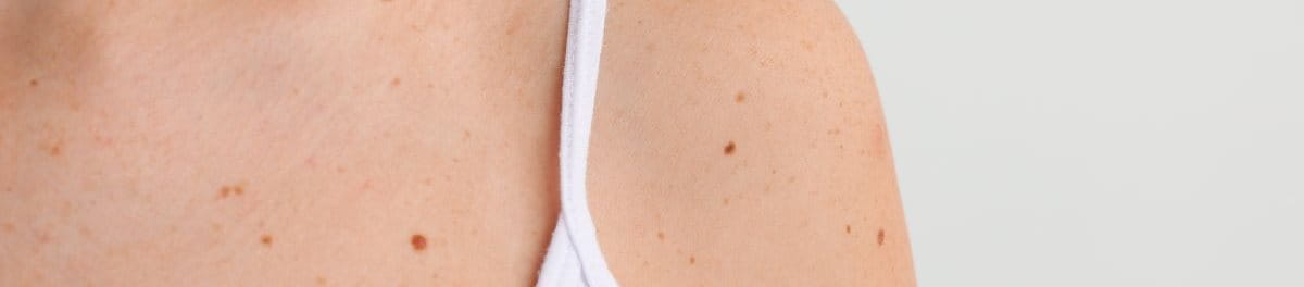 ขี้แมลงวัน