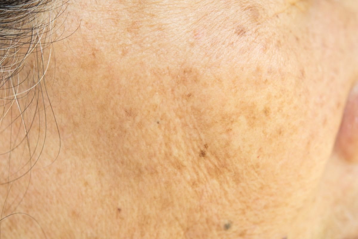 กระเนื้อ