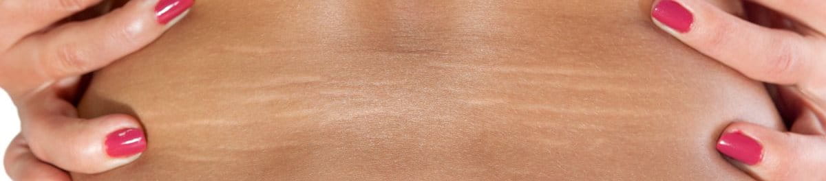 รอยแตกลาย