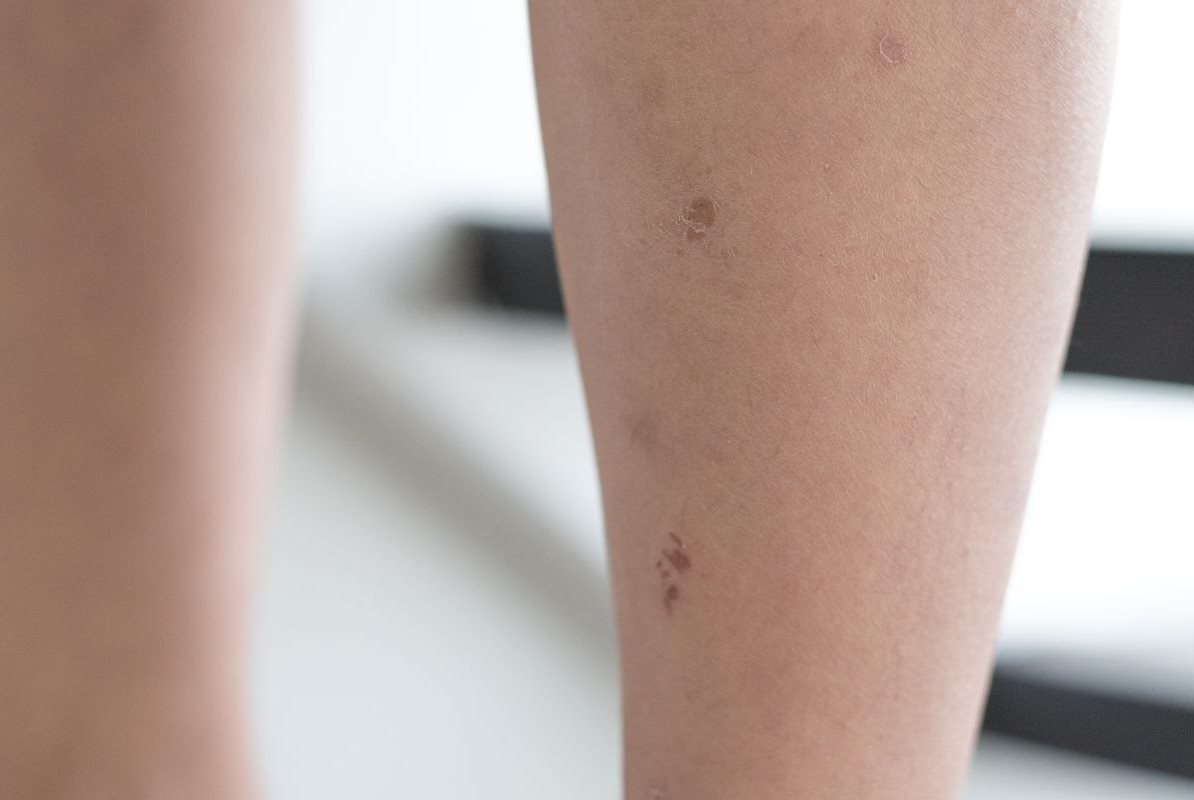 āļāđāļģāđāļŦāļĨāļ·āļāļāđāļĄāđāļāļĩ