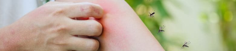 ยุงกัด แพ้ยุง