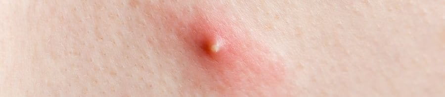 āļŠāļīāļ§āļŦāļąāļ§āļŦāļāļāļ