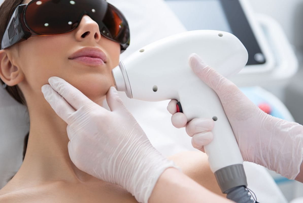 เลเซอร์หน้า