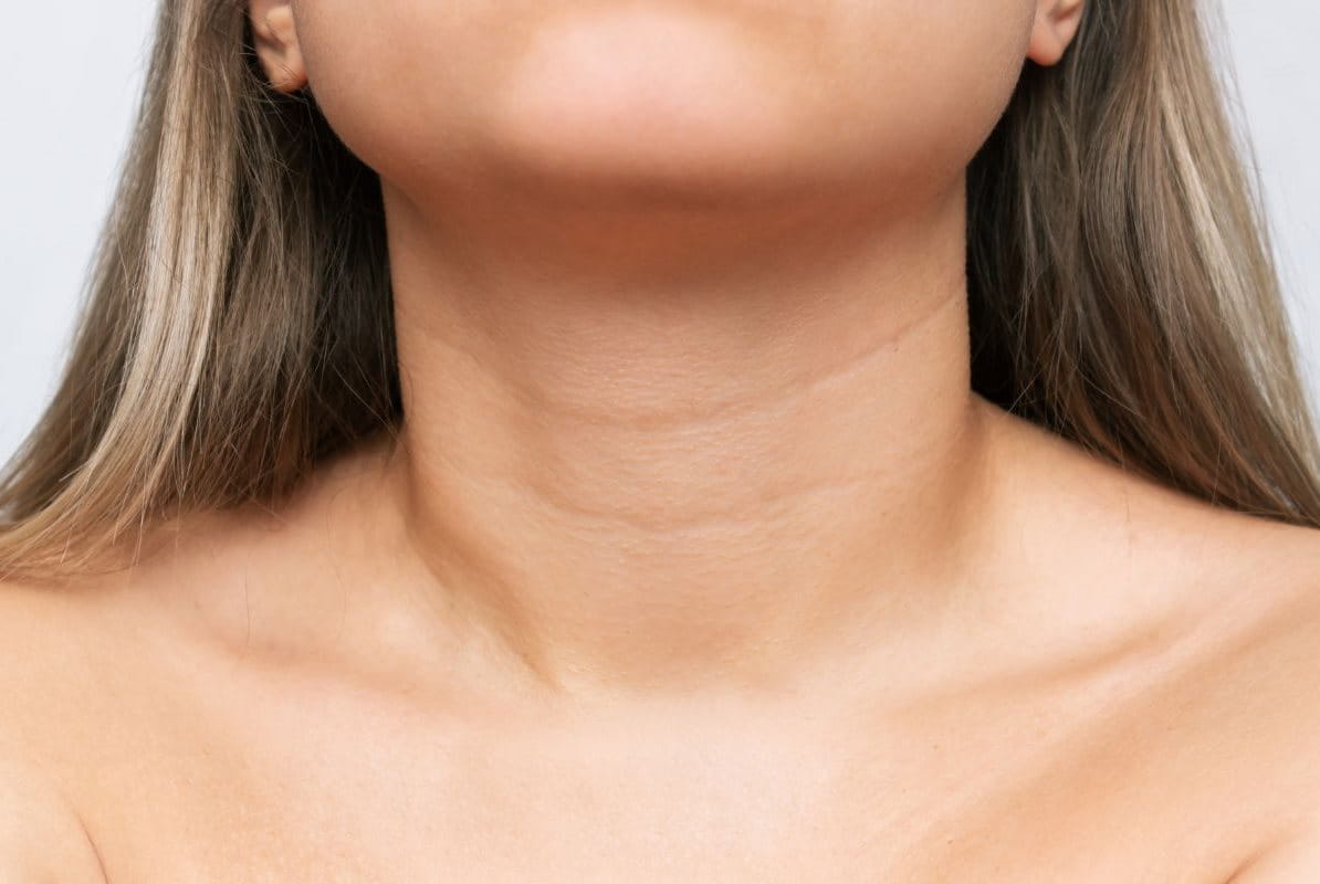 คอนเป็นเส้น