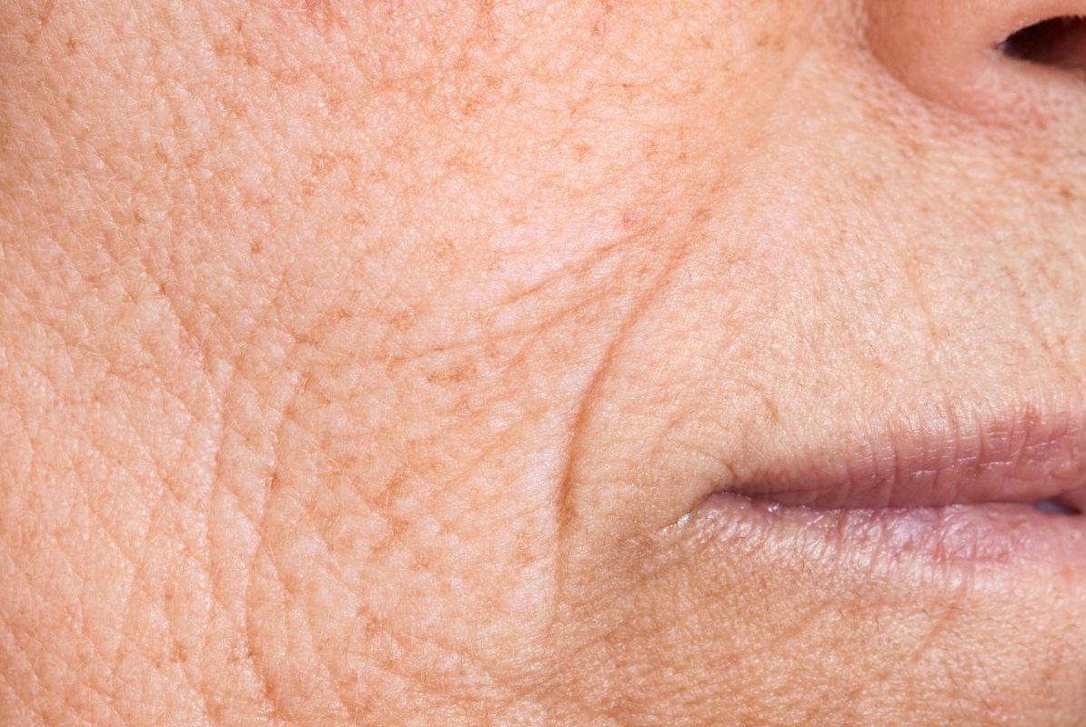 ร่องน้ำหมาก