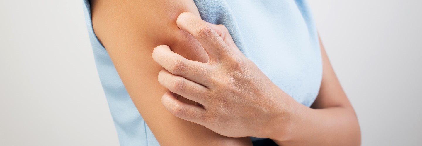 A woman scratches her dry skin on her arm.