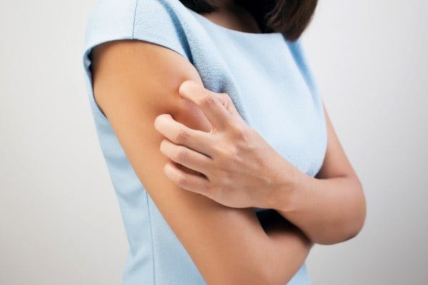 A woman scratches her dry skin on her arm.