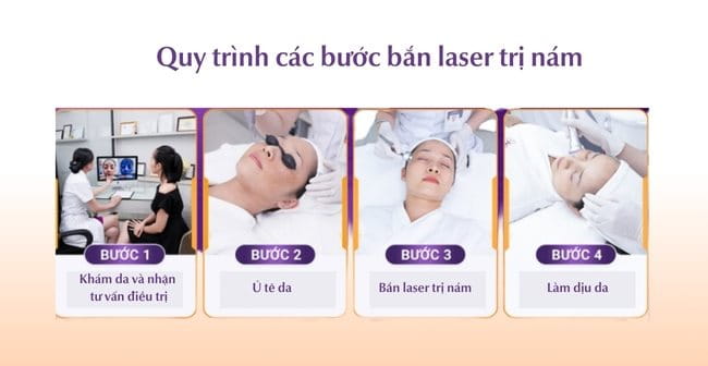 Quy trình bắn laser nám