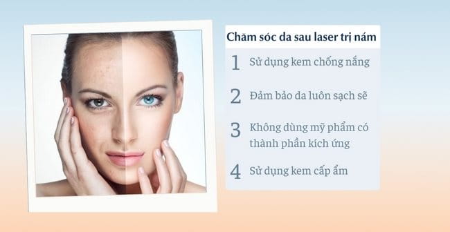 Hướng dẫn chăm sóc da sau khi bắn laser trị nám