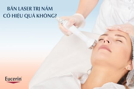 Trị nắm bằng laser