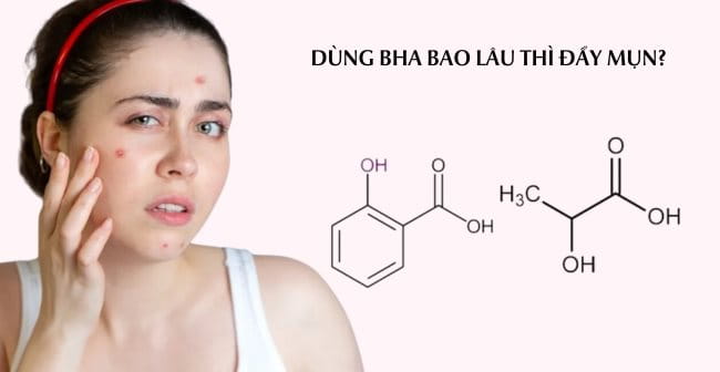 Dùng BHA bao lâu thì đẩy mụn?