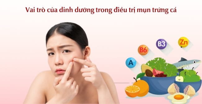 Vai trò của dinh dưỡng trong điều trị mụn trứng cá