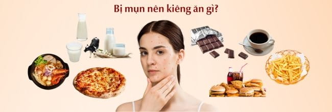 Bị mụn nên kiêng ăn gì? Chế độ ăn cho người bị mụn