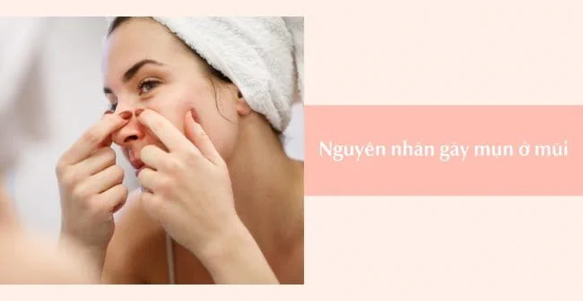 Nguyên nhân gây các loại mụn ở mũi