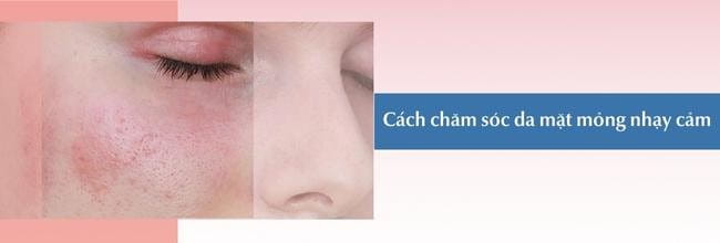 Cách chăm sóc da mặt mỏng nhạy cảm giúp phục hồi da mặt bị mỏng khỏi tổn thương