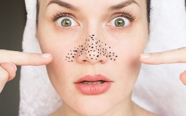 chăm sóc da mụn đầu đen