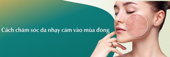 Cách chăm sóc da nhạy cảm vào mùa đông hiệu quả