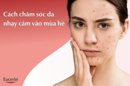 Cách chăm sóc da nhạy cảm vào mùa hè đúng cách, hiệu quả