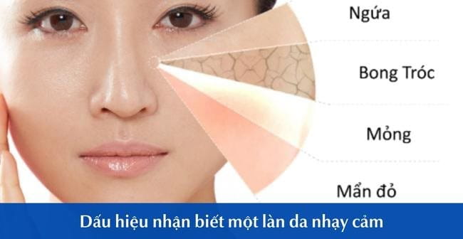 Dấu hiệu nhận biết làn da nhạy cảm