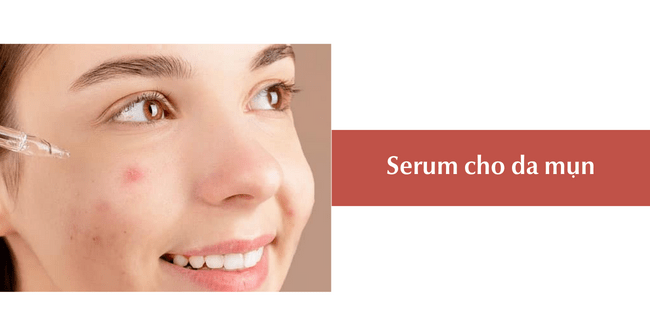 Cách dùng serum cho da mụn