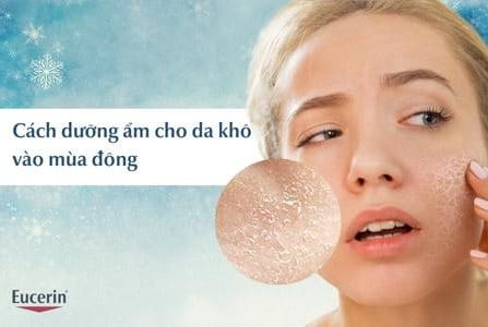 Cách dưỡng ẩm cho da khô vào mùa đông đúng chuẩn