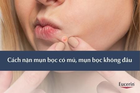 7. Những sai lầm thường gặp khi nặn mụn bọc không đầu