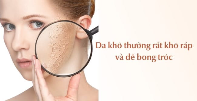 Da khô có dấu hiệu bong tróc