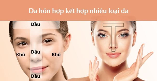 Da hỗn hợp kết hợp nhiều loại da