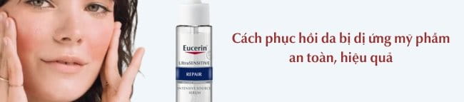 Phục hồi da dị ứng mỹ phẩm