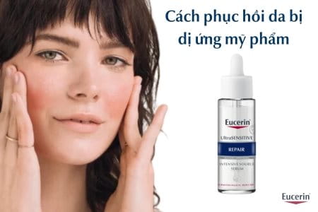 Cách phục hồi da bị dị ứng mỹ phẩm tại nhà hiệu quả, an toàn
