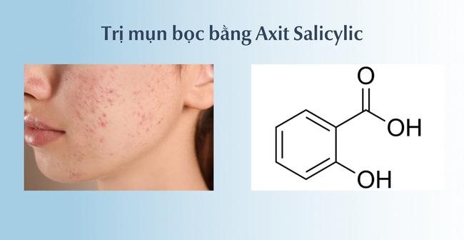 Trị mụn bọc bằng Axit Salicylic