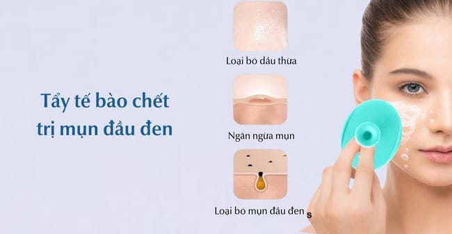 Cách trị mụn đầu đen phổ biến - Tẩy da chết