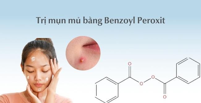 Dùng Benzoyl Peroxide trị mụn mủ